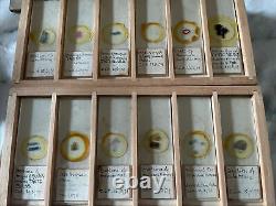 72 Antique Microscope Slides Mostly Human Dated c1870s By C. J. H 12 Photographs