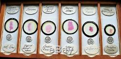 Antique Cased MICROSCOPE SLIDES (36) by WATSON & COLE, HUMAN PATHOLOGY