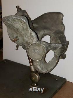 Antique Vintage Medical Pelvis Back Bones Clay-adams Skeletons Ny Museum Quality