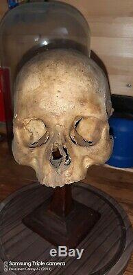 Antique real medicalHuman Skull! Very rare! Modèle crâne humain médical réel