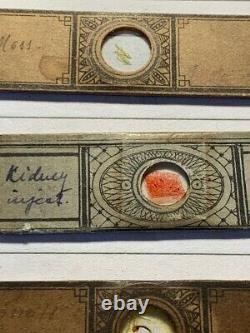 Collection of 11 Antique Paper-covered Prepared Microscope Slides