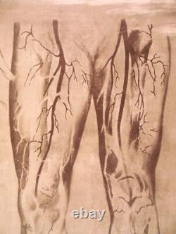 Slab Die Zinc Lithographs Body Human modello anatomico 2 Skull Vintage