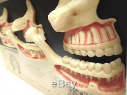 Teeth & Jaws Wax Models Human Anatomy Berlin Tooth Development
