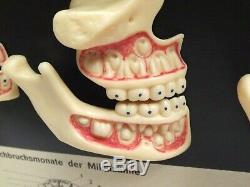 Teeth & Jaws Wax Models Human Anatomy Berlin Tooth Development