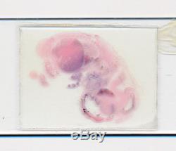 Vintage/Antique Microscope Slide. Entire Human Fetus 2 Months Old