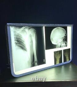 Vintage French Medical X-ray Film Viewer